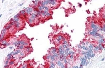 Immunohistochemistry-Paraffin: ADAM20 Antibody [NBP3-14531] - ADAM20 antibody IHC of human prostate. Immunohistochemistry of formalin-fixed, paraffin-embedded tissue after heat-induced antigen retrieval.